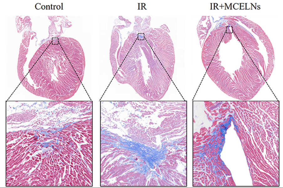 Protective effects of Bitter melon exosome on mice post-radiation